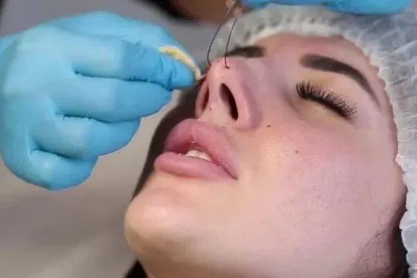 What is Nose Tip Aesthetics?