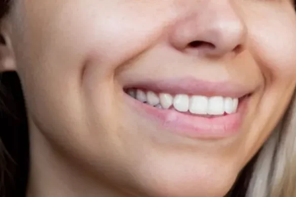 What is Dimple Aesthetics?