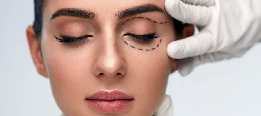 göz kapağı estetiği nedir